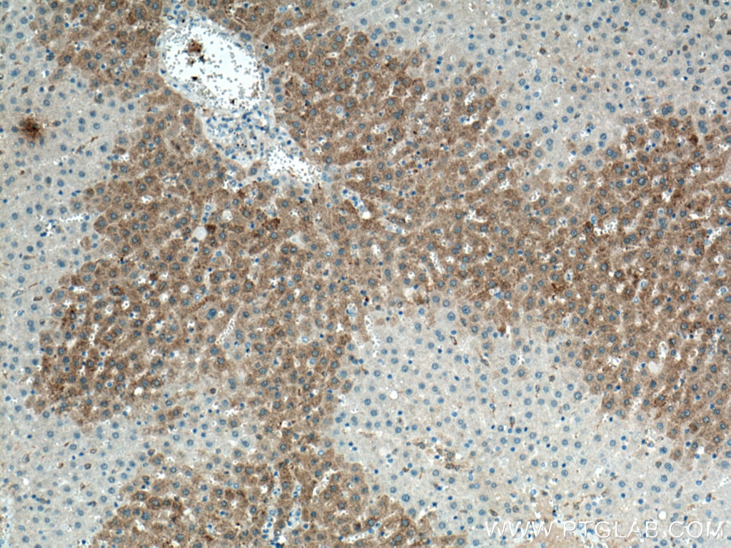 Immunohistochemistry (IHC) staining of rat liver tissue using Cyp2c7 Polyclonal antibody (55452-1-AP)