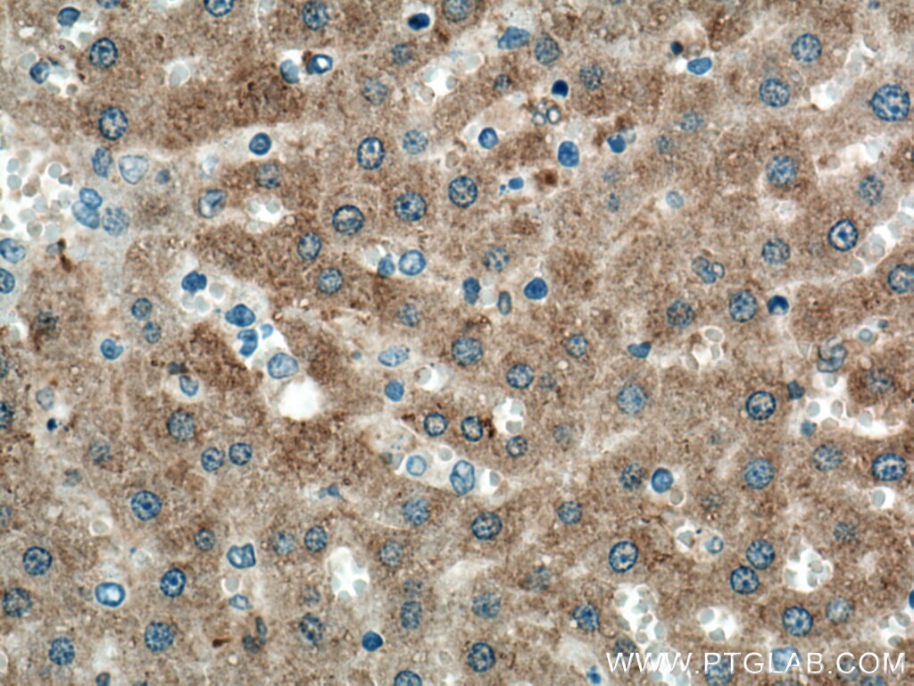 Immunohistochemistry (IHC) staining of rat liver tissue using Cyp2c7 Polyclonal antibody (55452-1-AP)