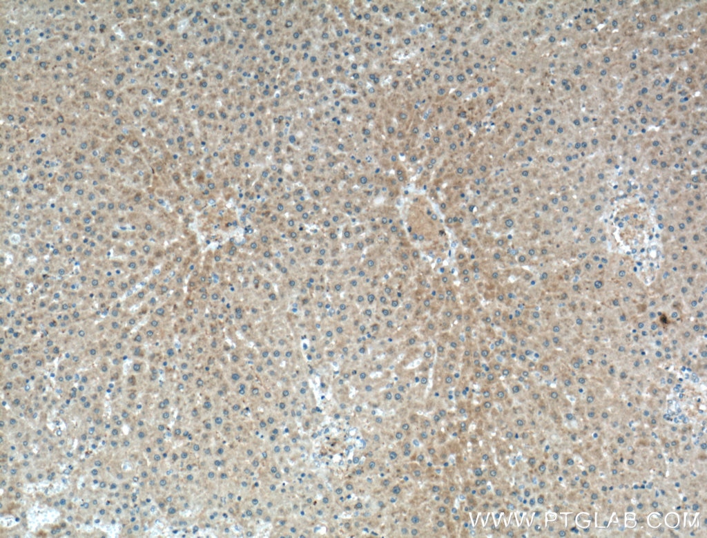 Immunohistochemistry (IHC) staining of rat liver tissue using Cyp4a12a Polyclonal antibody (51157-1-AP)