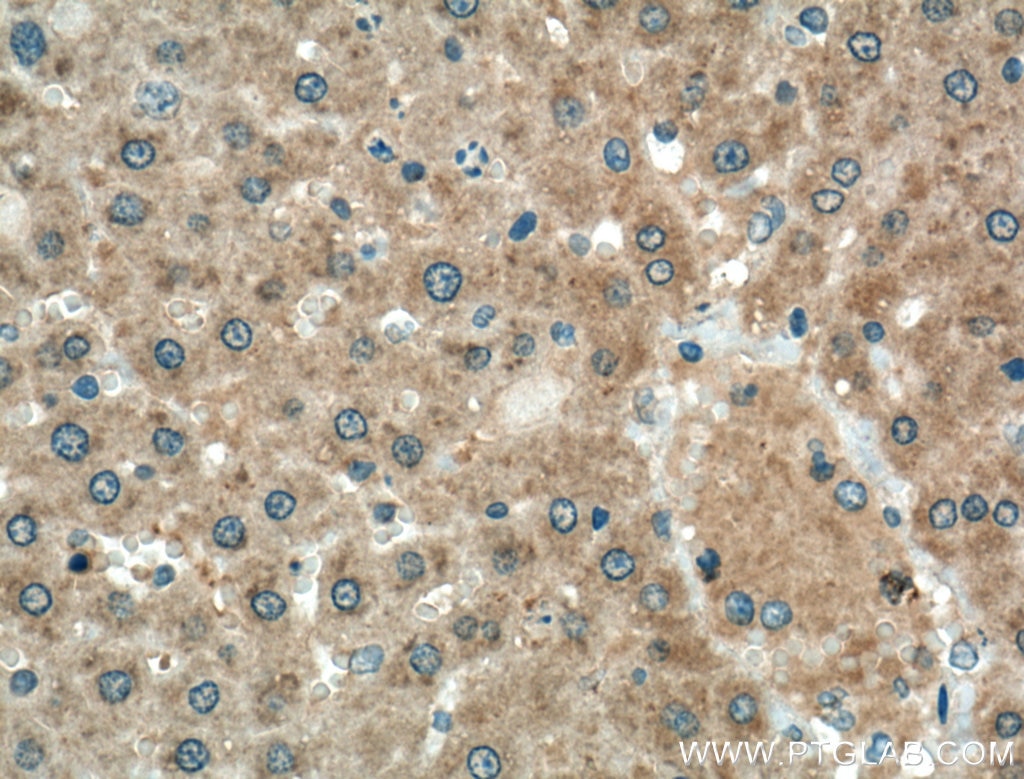 Immunohistochemistry (IHC) staining of rat liver tissue using Cyp4a12a Polyclonal antibody (51157-1-AP)