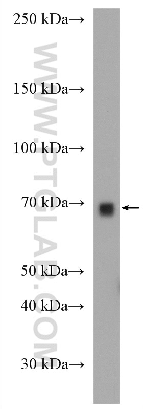 Western Blot (WB) analysis of mouse liver tissue using Cyp4a12a Polyclonal antibody (51157-1-AP)