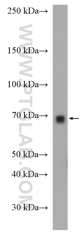 WB analysis of mouse liver using 51157-1-AP