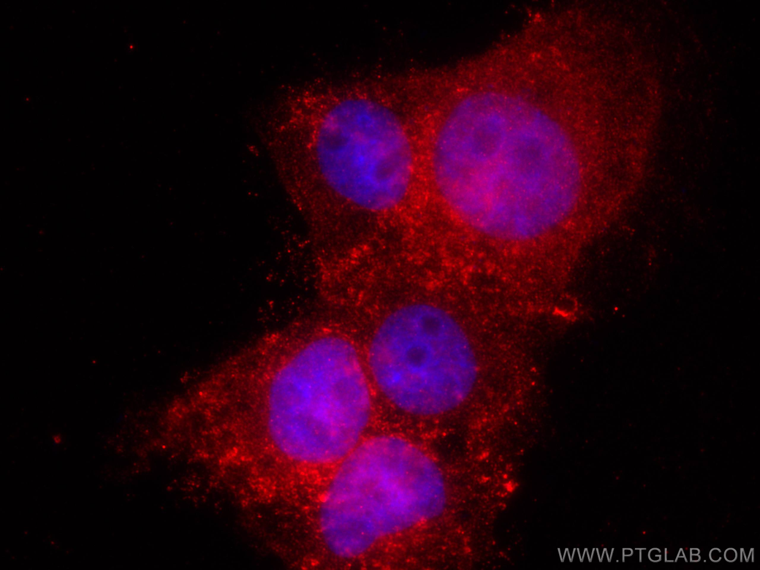 Immunofluorescence (IF) / fluorescent staining of A431 cells using Cystatin B Monoclonal antibody (66812-1-Ig)