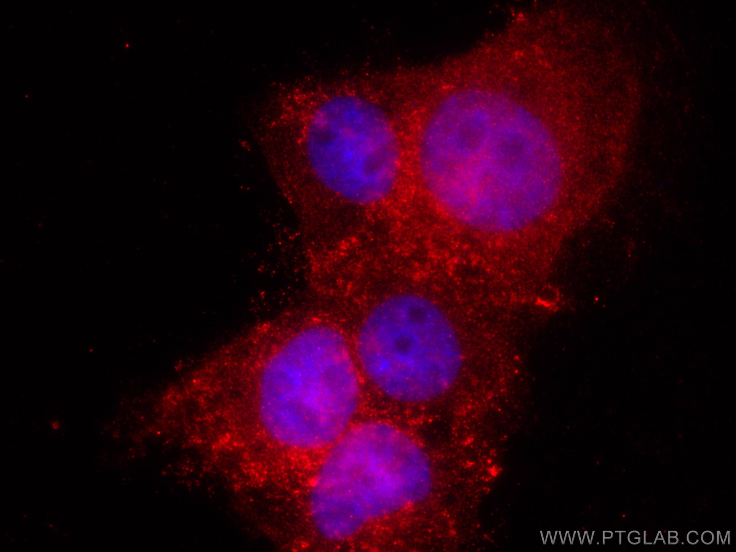 Immunofluorescence (IF) / fluorescent staining of A431 cells using Cystatin B Monoclonal antibody (66812-1-Ig)