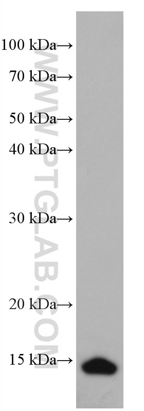 Western Blot (WB) analysis of THP-1 cells using Cystatin B Monoclonal antibody (66812-1-Ig)