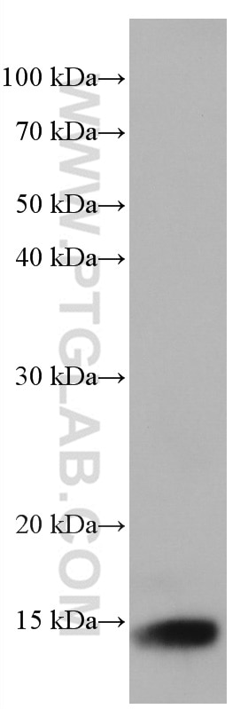 Western Blot (WB) analysis of U-937 cells using Cystatin B Monoclonal antibody (66812-1-Ig)