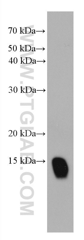 Western Blot (WB) analysis of human saliva using Cystatin B Monoclonal antibody (66812-1-Ig)