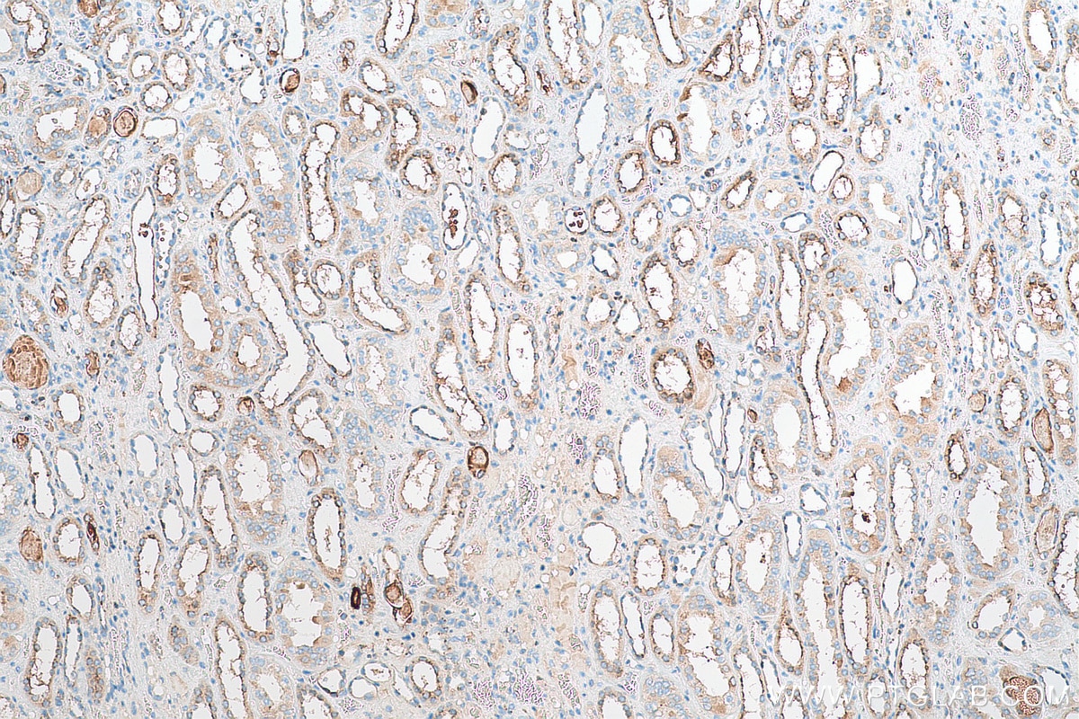 Immunohistochemistry (IHC) staining of human kidney tissue using Cystatin C Recombinant antibody (82441-1-RR)