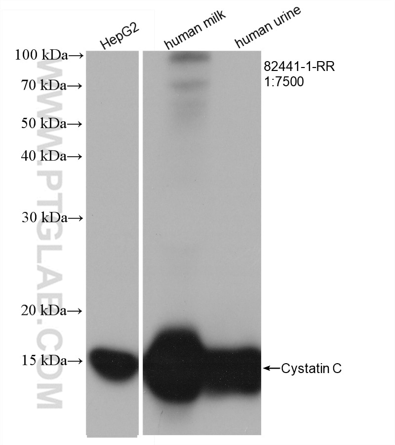 Western Blot (WB) analysis of various lysates using Cystatin C Recombinant antibody (82441-1-RR)