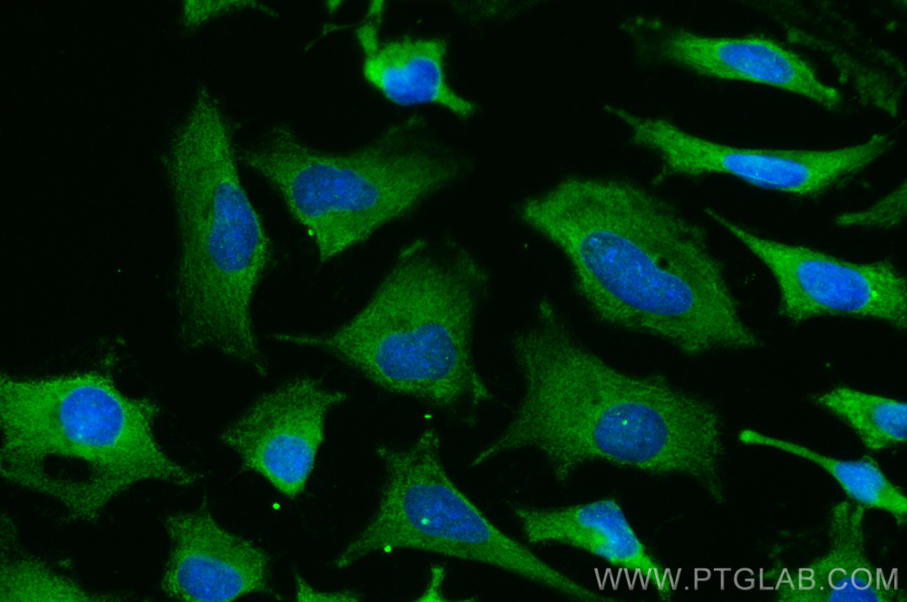 Immunofluorescence (IF) / fluorescent staining of HeLa cells using CoraLite® Plus 488-conjugated Cystatin C Polyclona (CL488-12245)