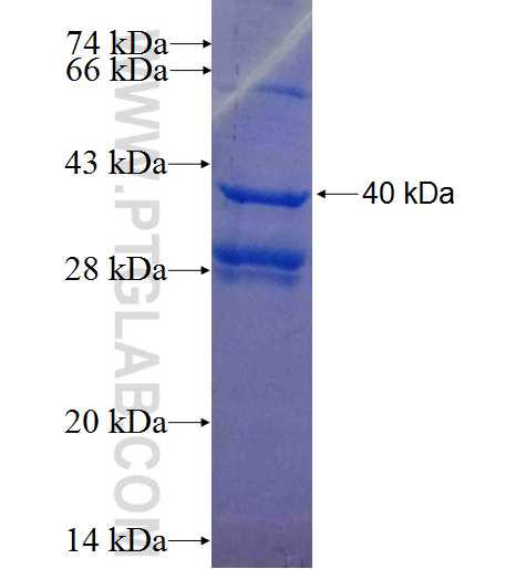Cystatin C fusion protein Ag2890 SDS-PAGE