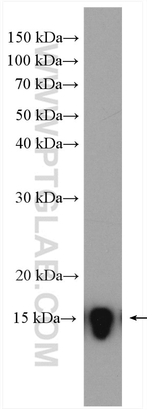 Western Blot (WB) analysis of human saliva using Cystatin S Polyclonal antibody (26979-1-AP)