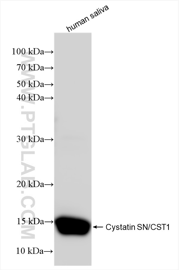 Western Blot (WB) analysis of human saliva using Cystatin SN/CST1 Recombinant antibody (85403-1-RR)