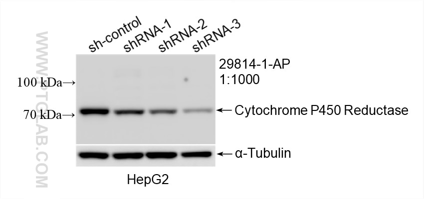 Cytochrome P450 Reductase