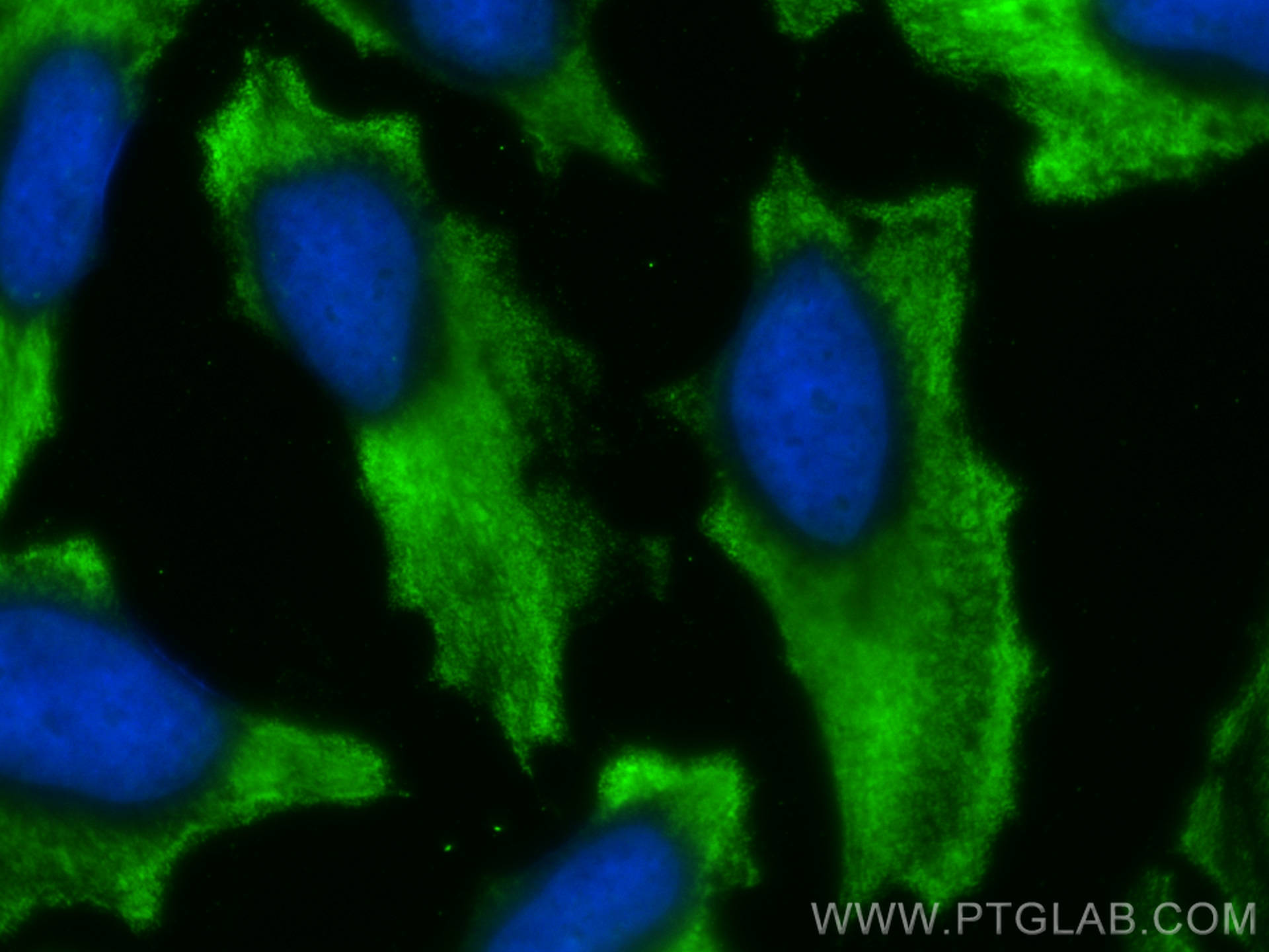 Immunofluorescence (IF) / fluorescent staining of HeLa cells using CoraLite® Plus 488-conjugated Cytoglobin Monoclona (CL488-60228)