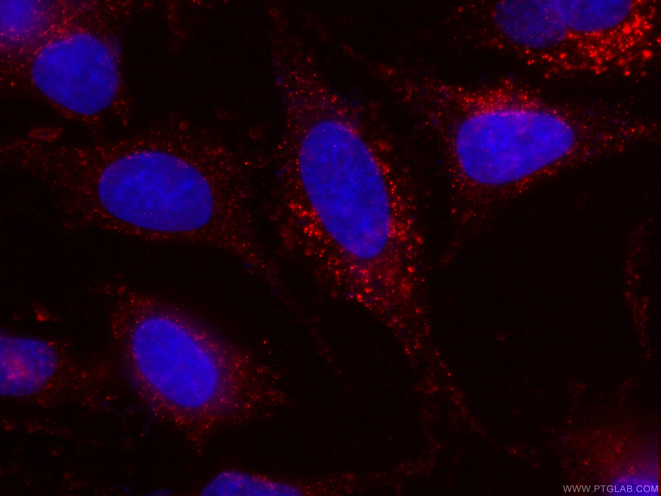 Cytoglobin