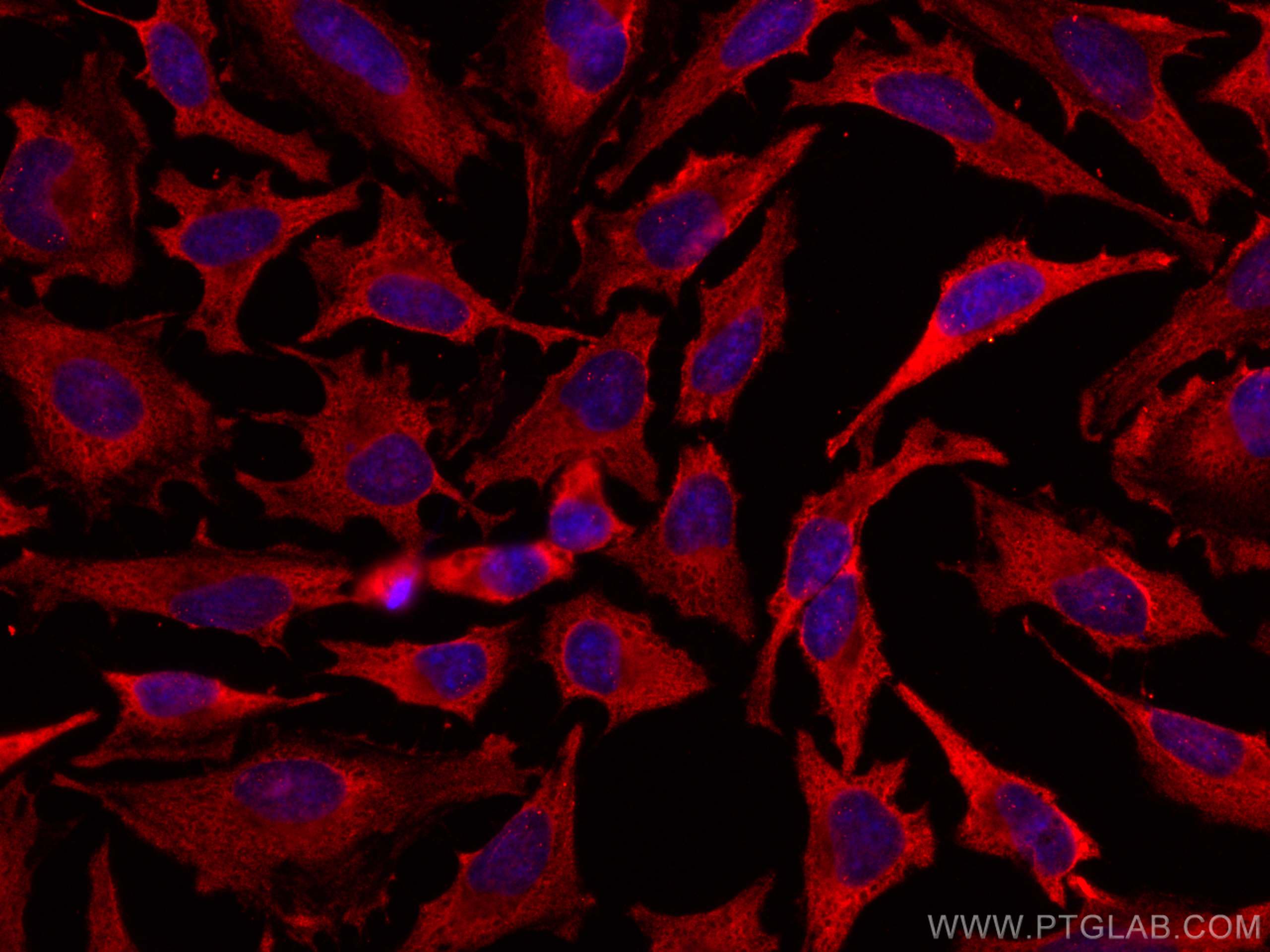 Immunofluorescence (IF) / fluorescent staining of HeLa cells using CoraLite®594-conjugated Cytoglobin Monoclonal anti (CL594-60228)