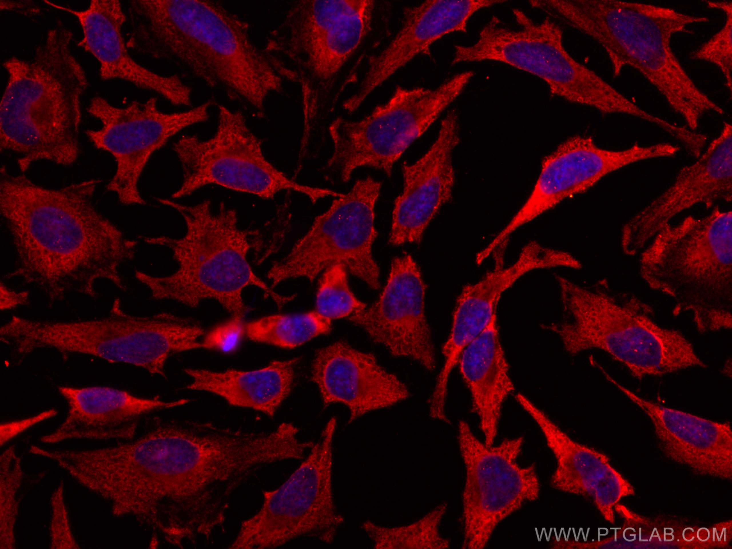 IF Staining of HeLa using CL594-60228