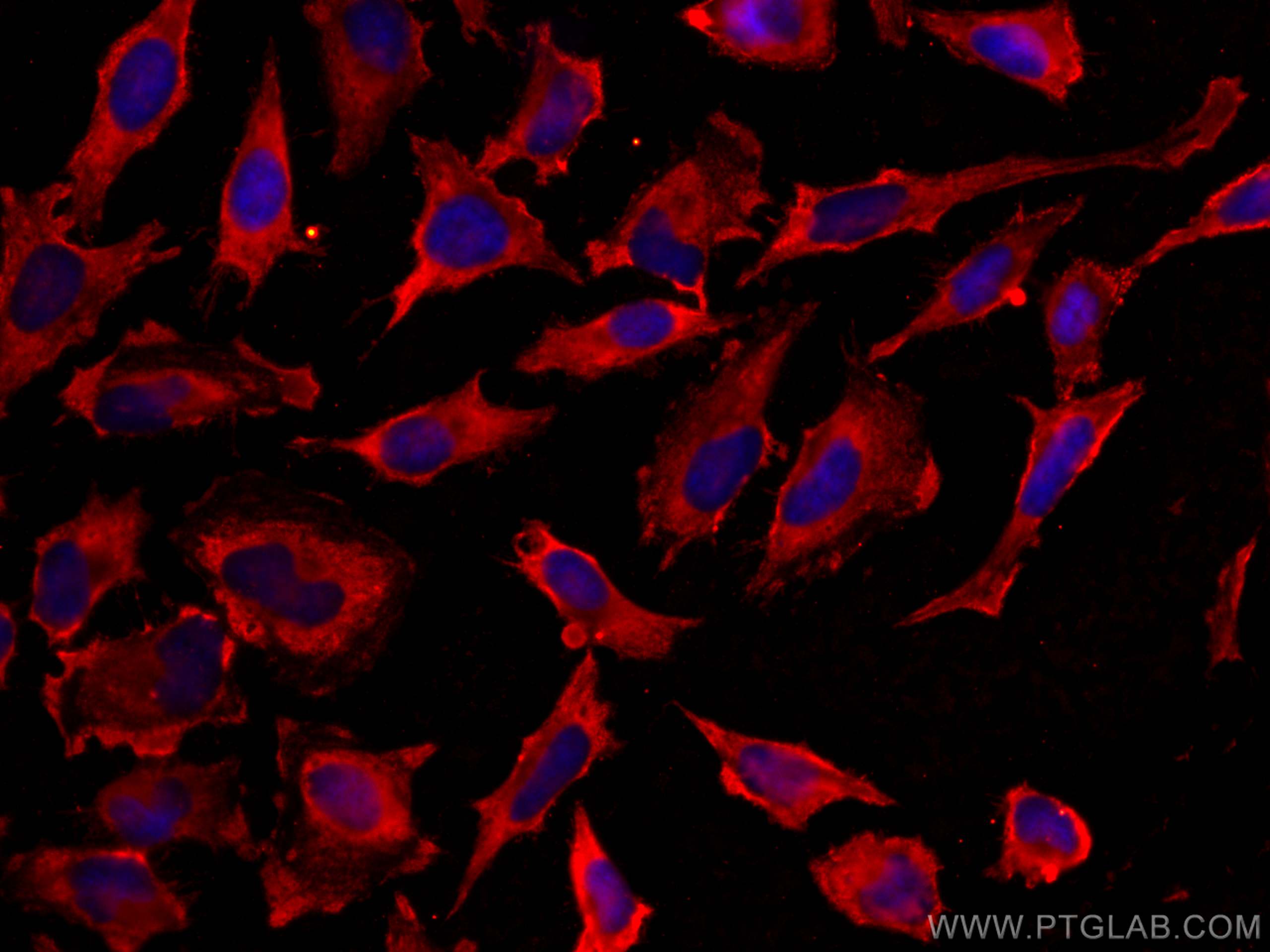 Immunofluorescence (IF) / fluorescent staining of HeLa cells using CoraLite®594-conjugated Cytoglobin Monoclonal anti (CL594-60228)