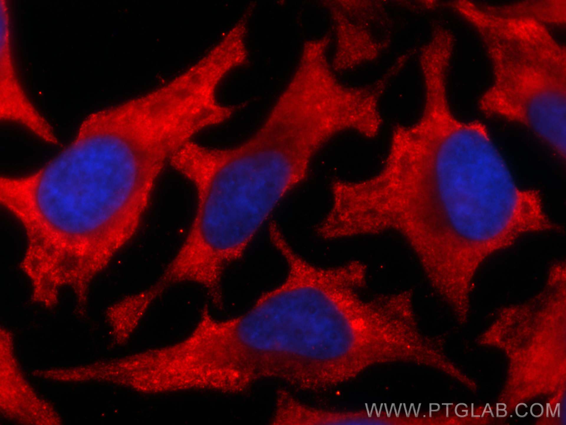 Immunofluorescence (IF) / fluorescent staining of HeLa cells using CoraLite®594-conjugated Cytoglobin Monoclonal anti (CL594-60228)