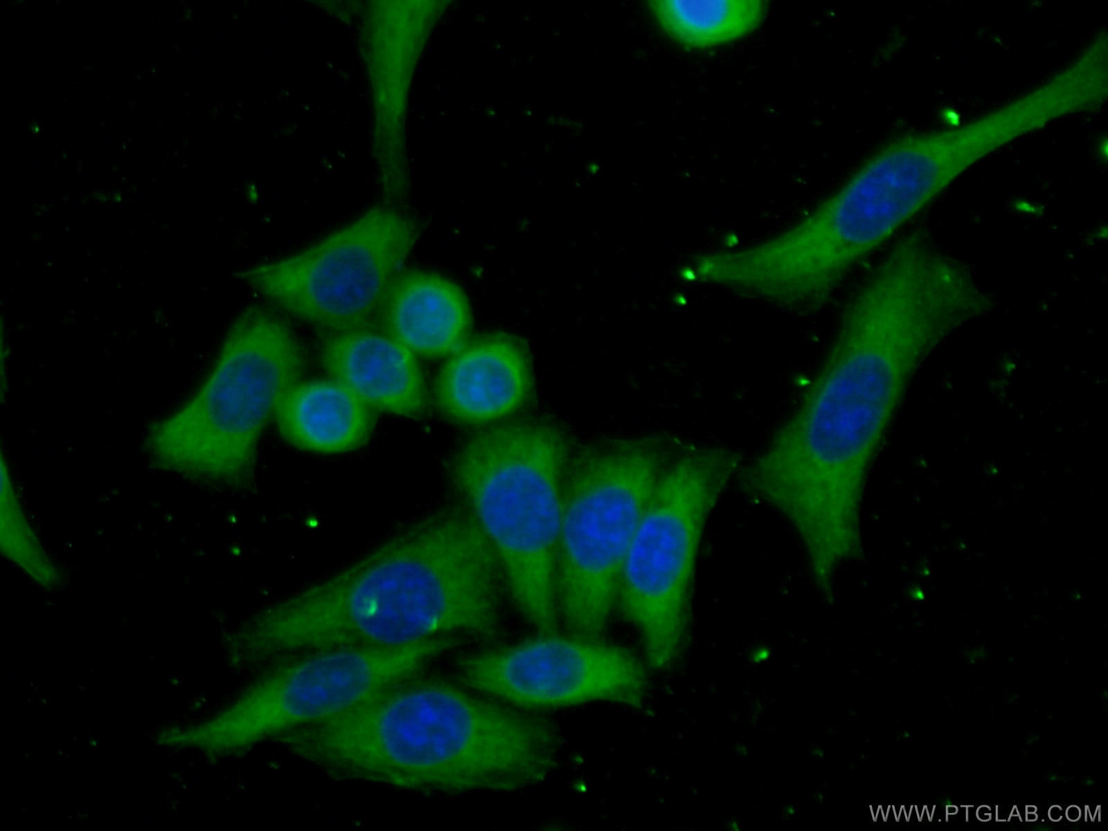 Immunofluorescence (IF) / fluorescent staining of HeLa cells using Cytohesin 2 Monoclonal antibody (67185-1-Ig)