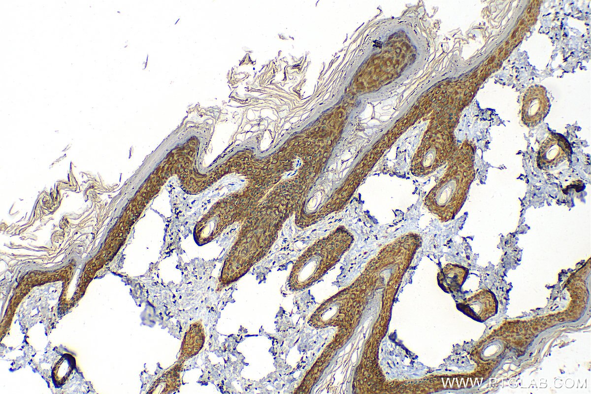 Immunohistochemical analysis of paraffin-embedded rat skin tissue slide using 82972-4-RR (Cytokeratin 1-specific antibody) at dilution of 1:1000 (under 10x lens). Heat mediated antigen retrieval with Tris-EDTA buffer (pH 9.0). Immunohistochemistry (IHC) staining of rat skin tissue using Cytokeratin 1-specific Recombinant antibody (82972-4-RR)