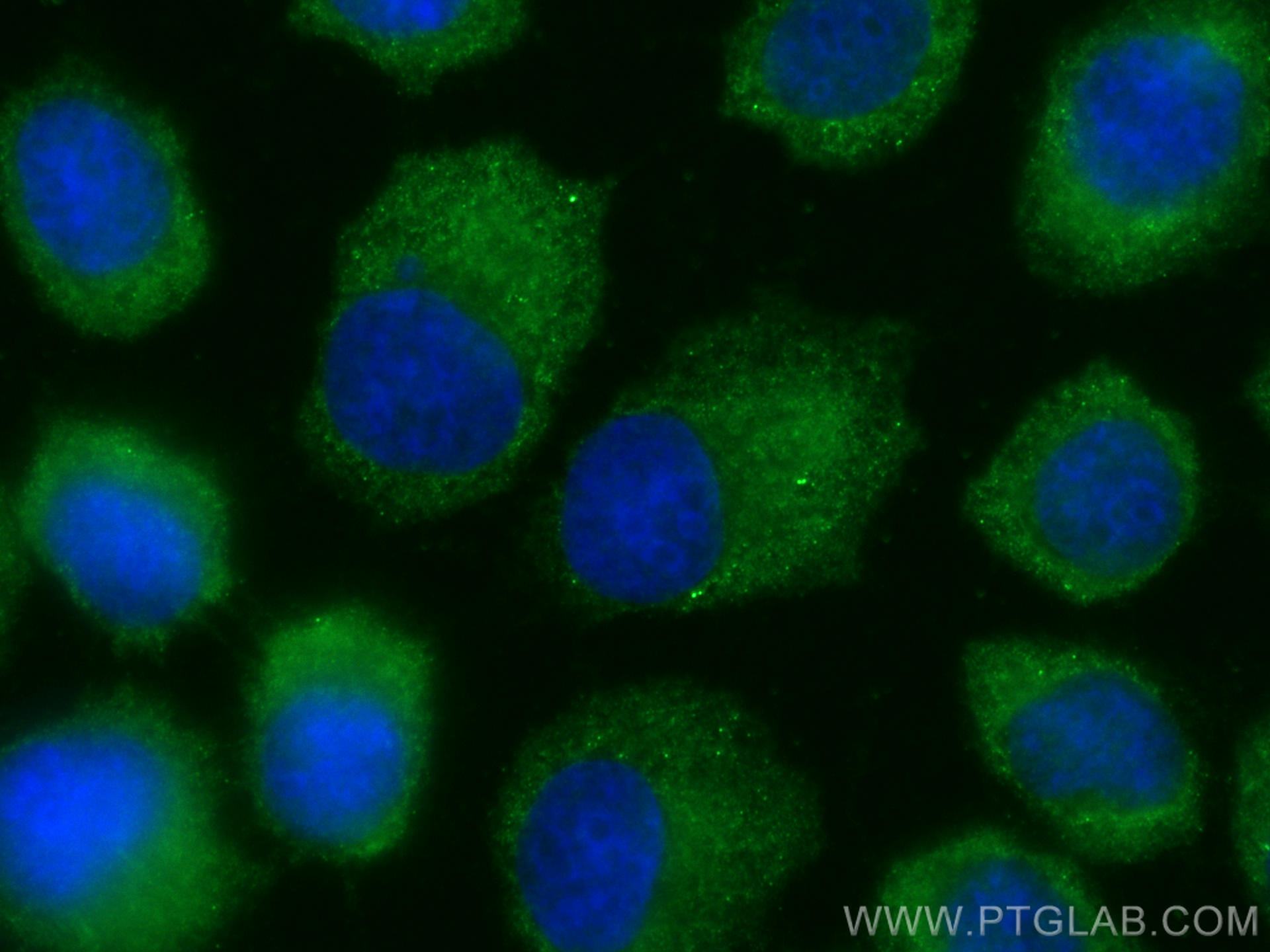 Immunofluorescence (IF) / fluorescent staining of A431 cells using CoraLite® Plus 488-conjugated Cytokeratin 1-specif (CL488-16848)