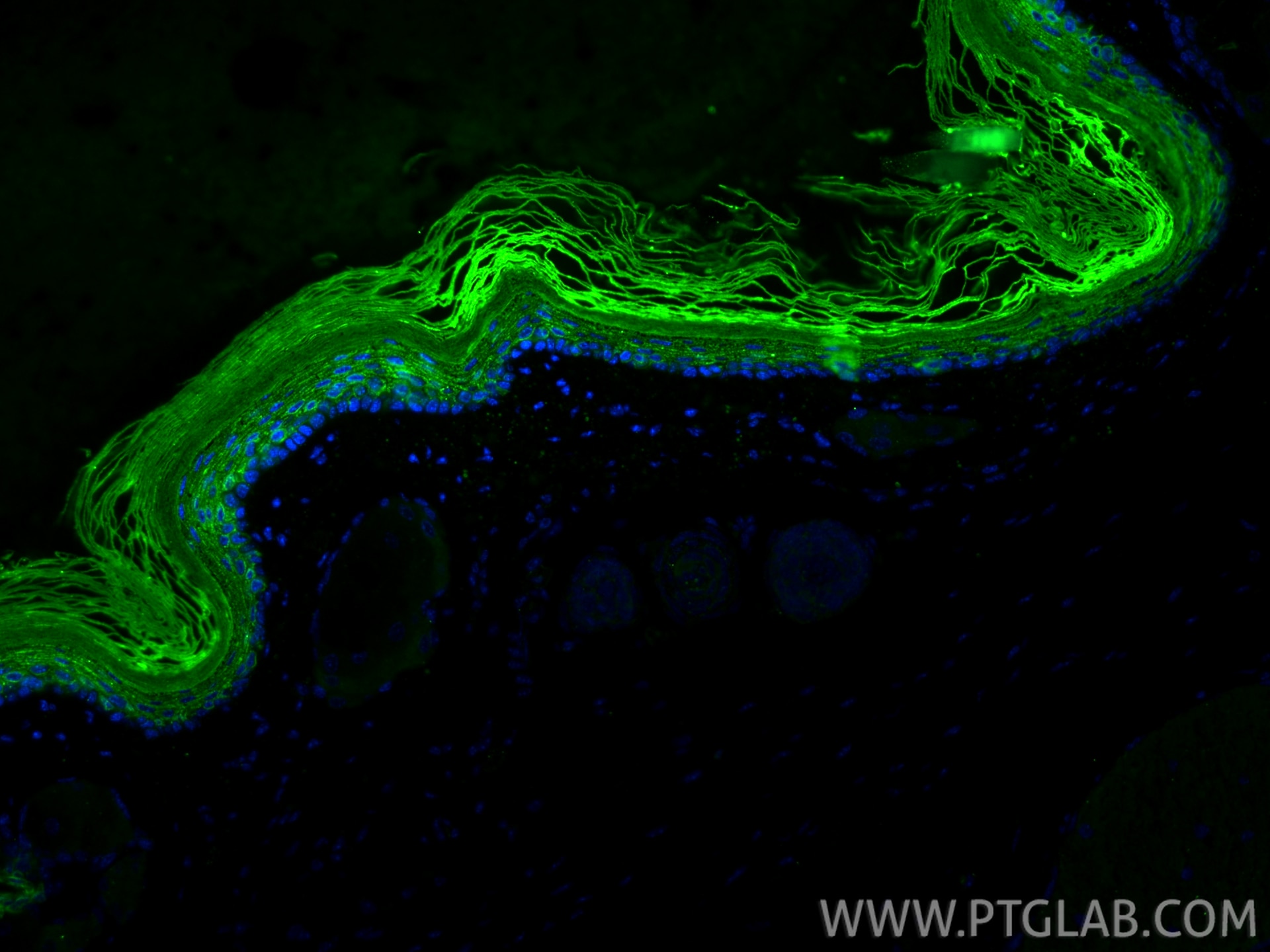 Immunofluorescence (IF) / fluorescent staining of mouse skin tissue using Cytokeratin 10 Recombinant monoclonal antibody (86324-1-RR)