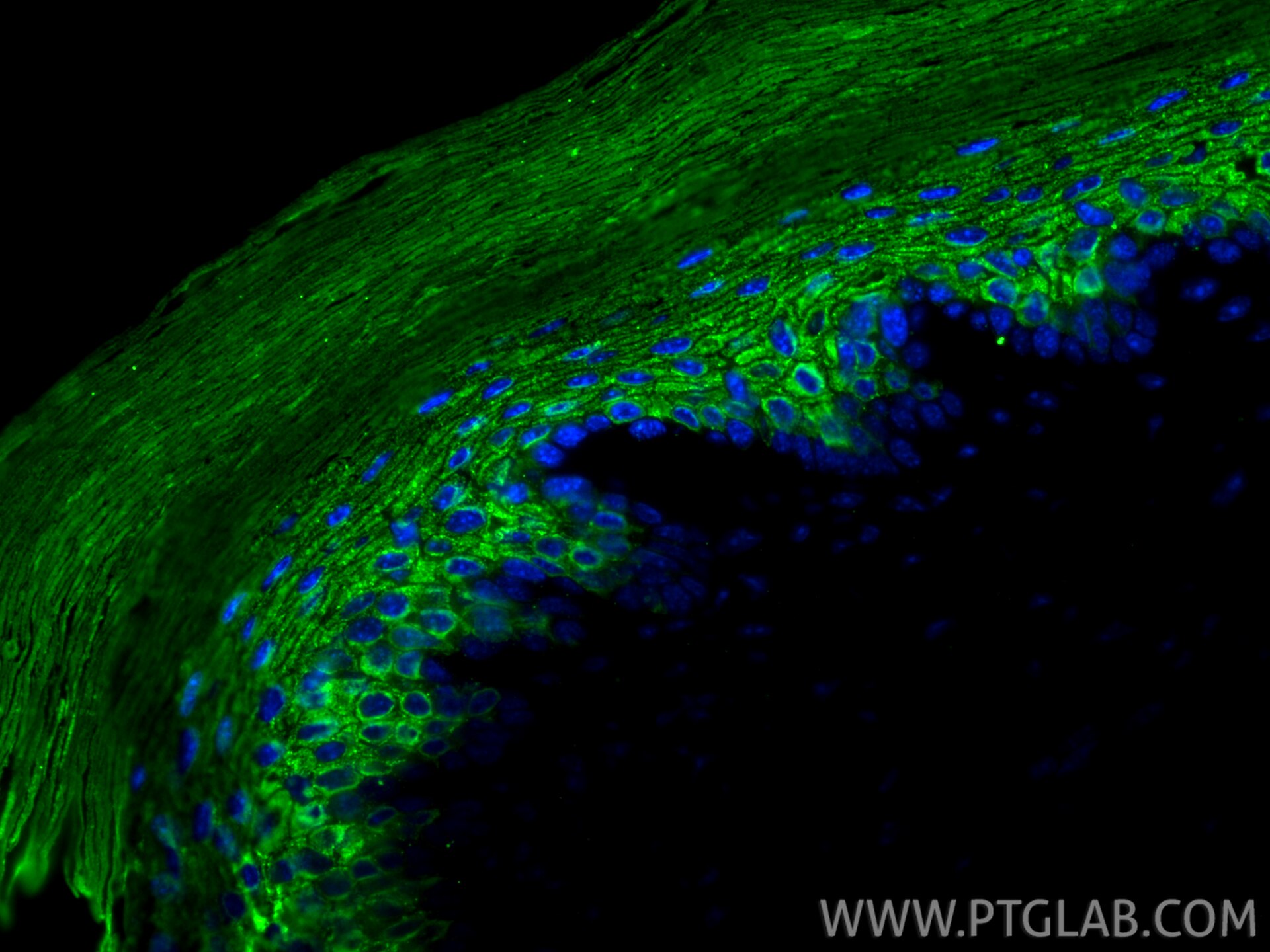 Immunofluorescence (IF) / fluorescent staining of mouse skin tissue using Cytokeratin 10 Recombinant monoclonal antibody (86324-1-RR)