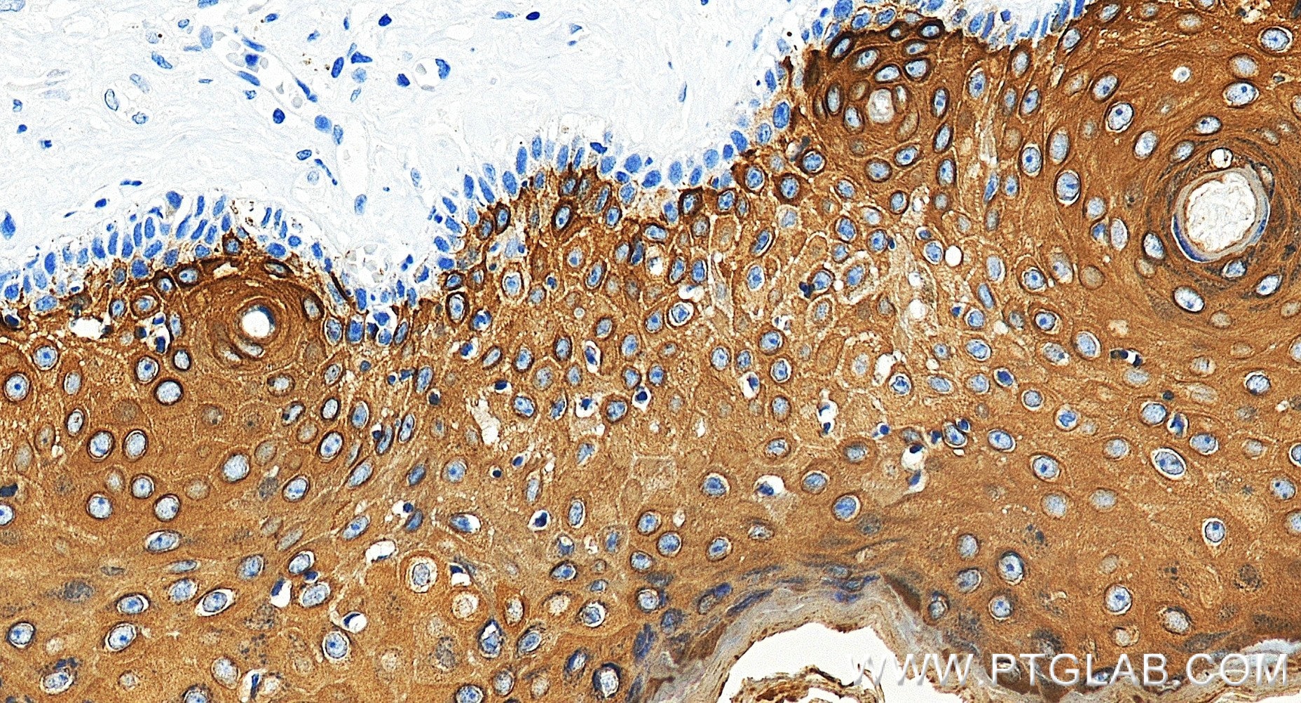 Immunohistochemistry (IHC) staining of human skin tissue using Cytokeratin 10 Recombinant monoclonal antibody (86324-1-RR)