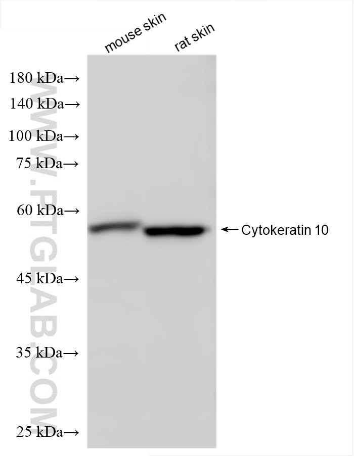 Western Blot (WB) analysis of various lysates using Cytokeratin 10 Recombinant antibody (86324-1-RR)