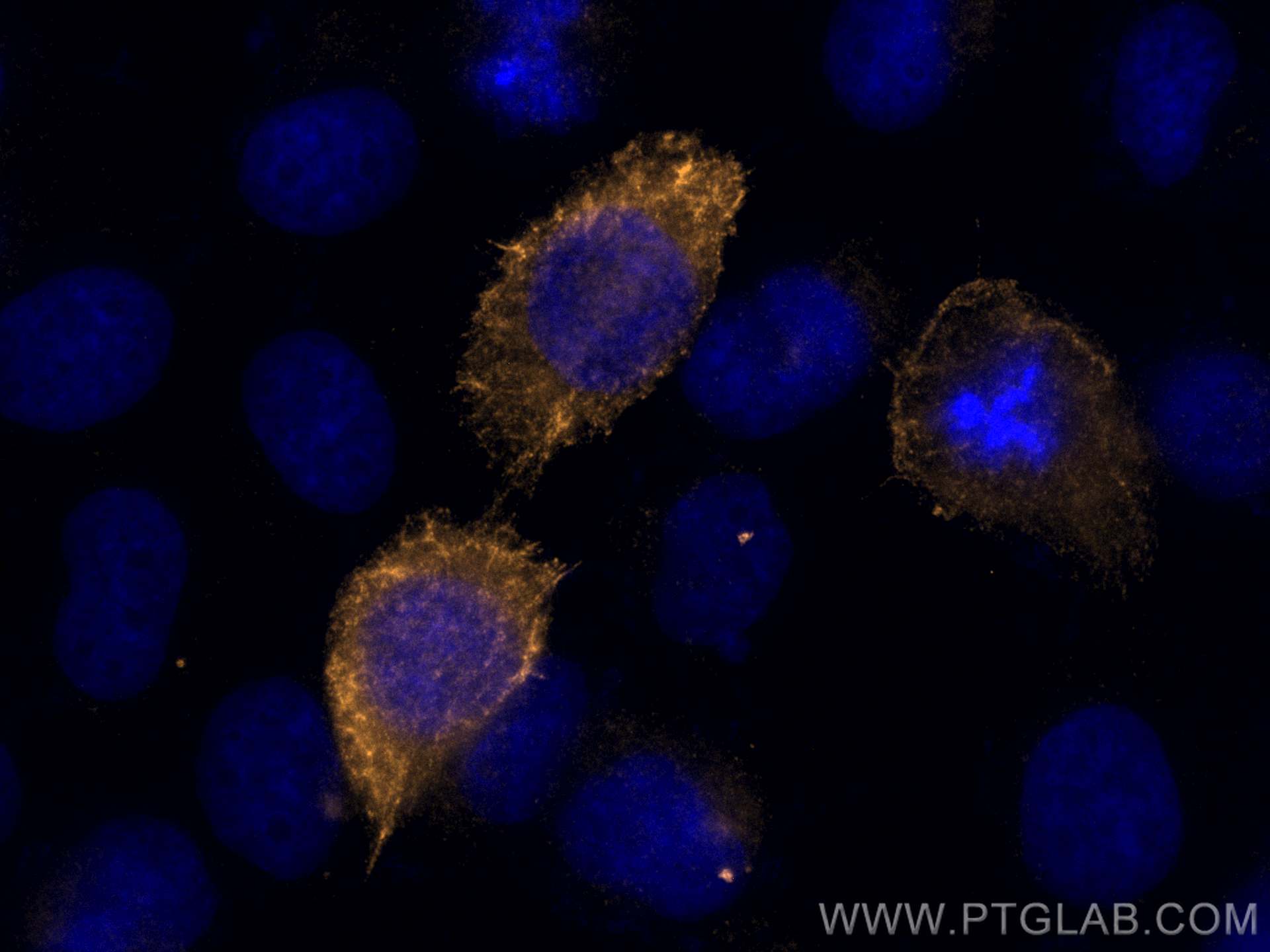 Cytokeratin 10