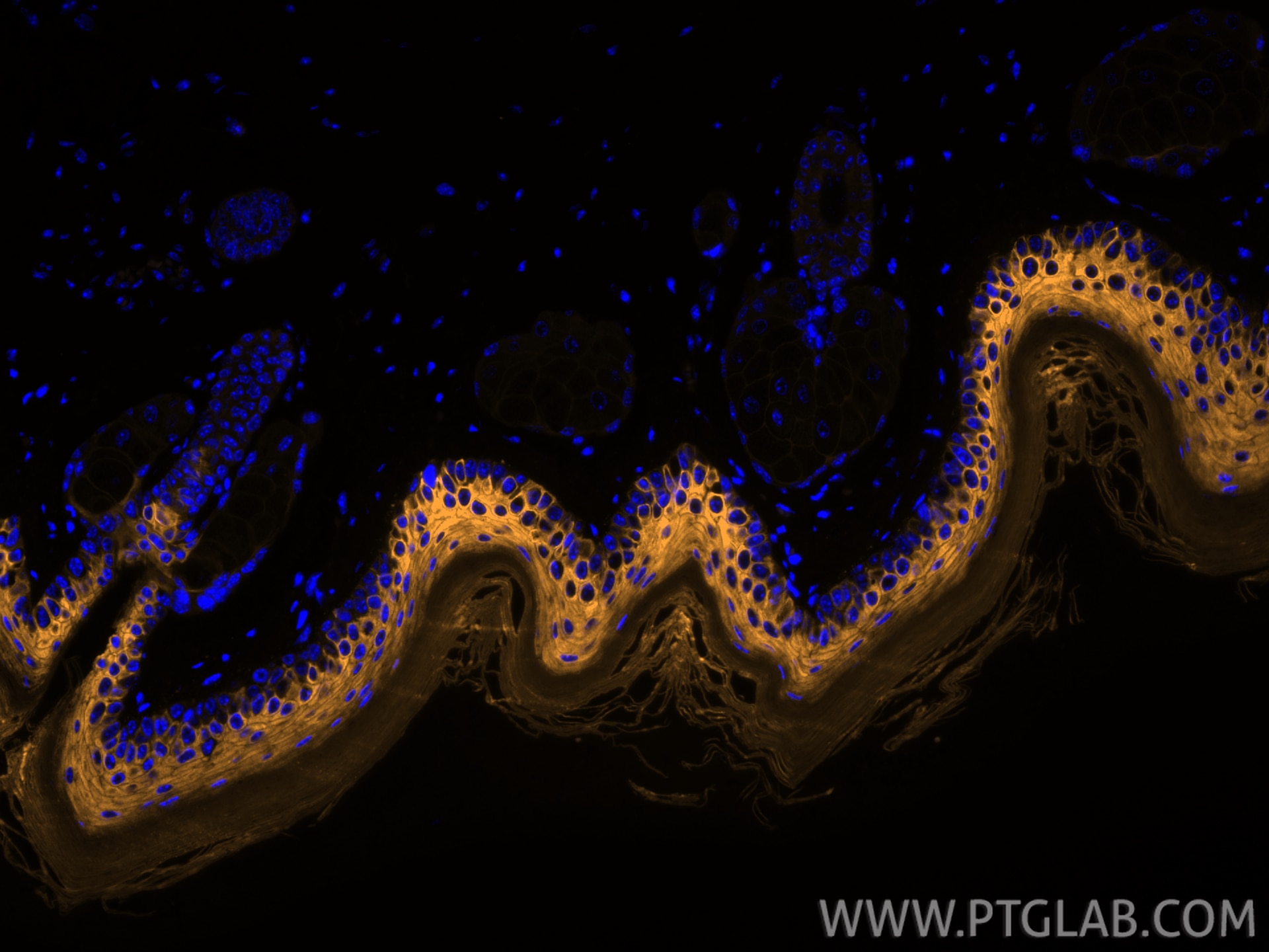 Immunofluorescence (IF) / fluorescent staining of mouse skin tissue using CoraLite® Plus 555-conjugated Cytokeratin 10 Polyc (CL555-18343)