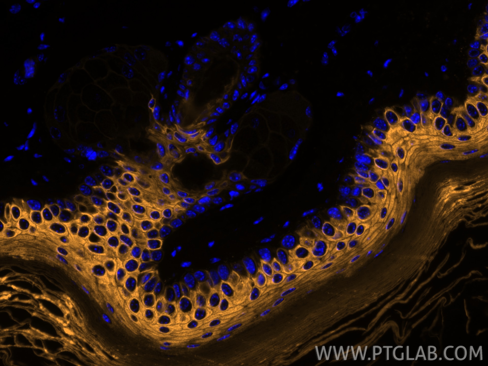 Immunofluorescence (IF) / fluorescent staining of mouse skin tissue using CoraLite® Plus 555-conjugated Cytokeratin 10 Polyc (CL555-18343)