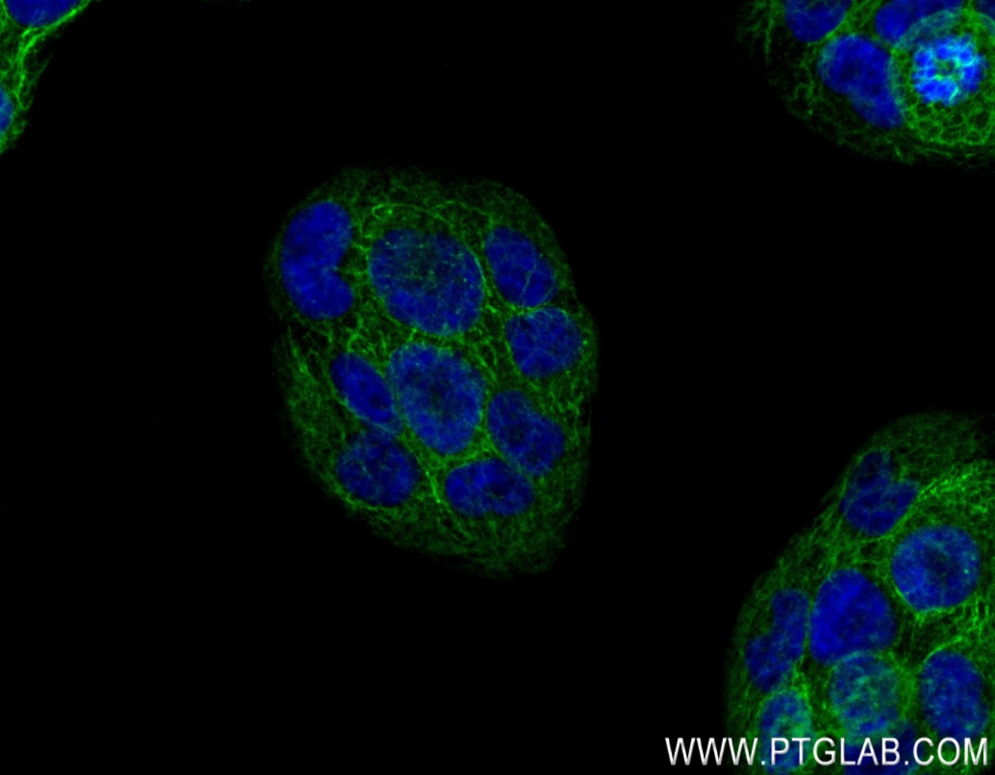 Immunofluorescence (IF) / fluorescent staining of HaCaT cells using Cytokeratin 13 Recombinant antibody (83058-1-RR)