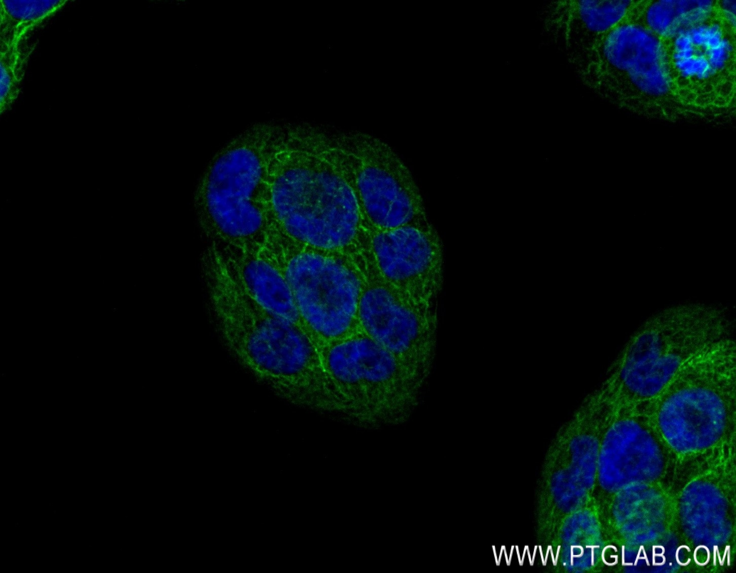 IF Staining of HaCaT using 83058-1-RR