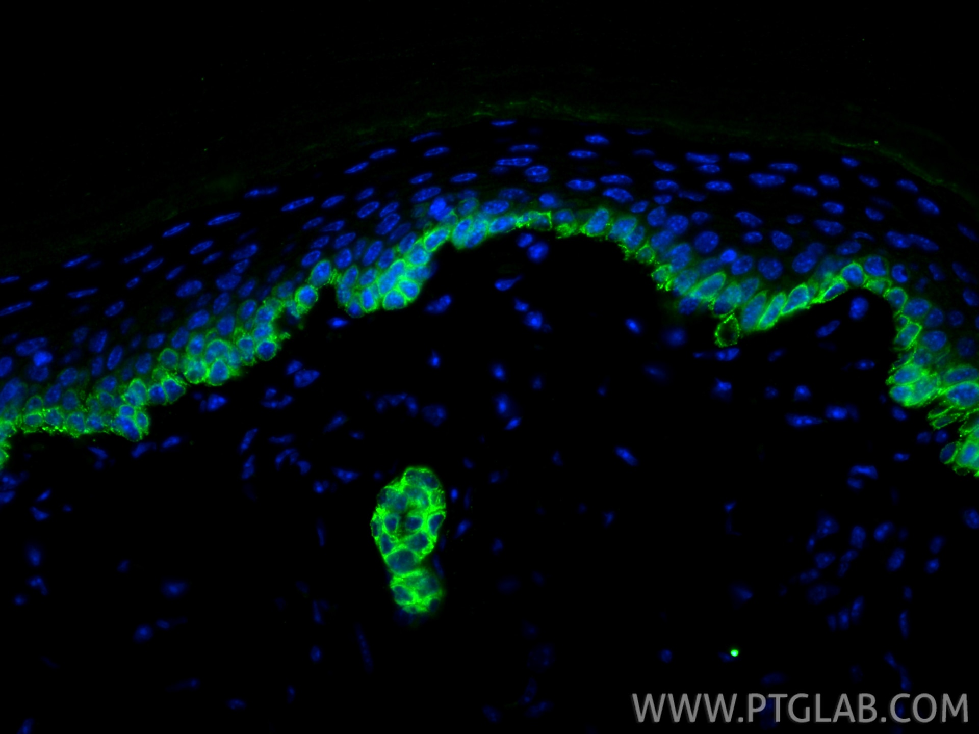 Immunofluorescence (IF) / fluorescent staining of mouse skin tissue using Cytokeratin 13 Recombinant antibody (83058-1-RR)
