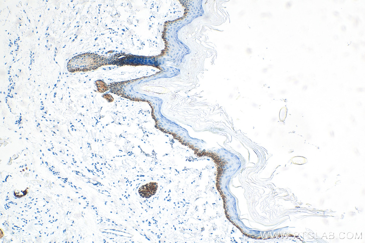 Immunohistochemistry (IHC) staining of rat skin tissue using Cytokeratin 13 Recombinant antibody (83058-1-RR)