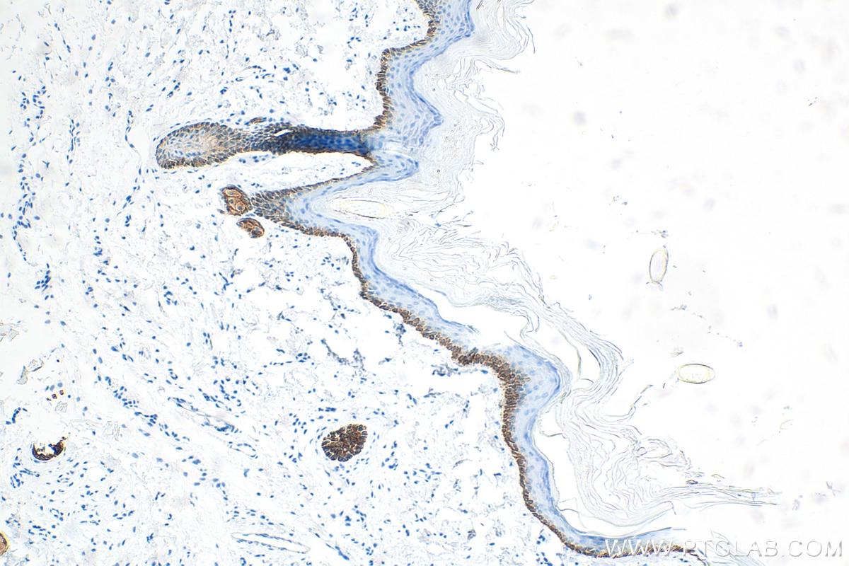 IHC staining of rat skin using 83058-1-RR