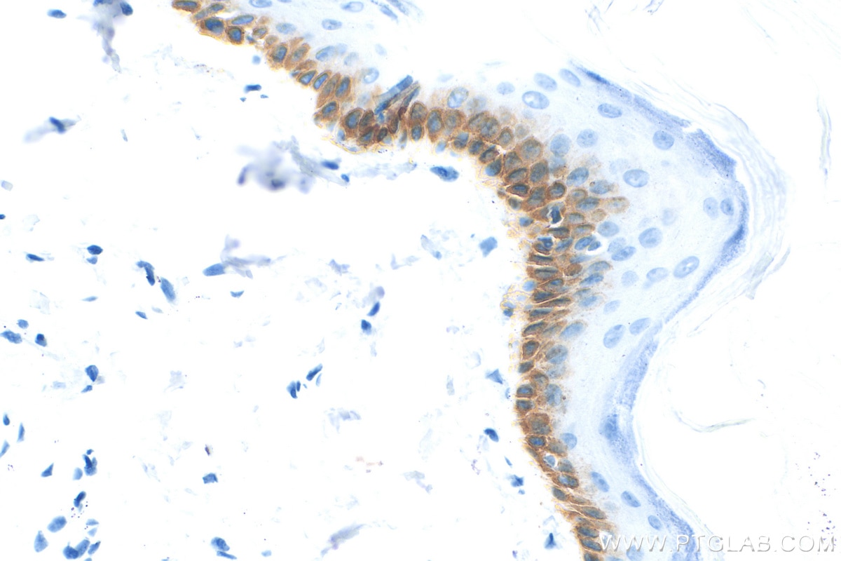 Immunohistochemistry (IHC) staining of rat skin tissue using Cytokeratin 13 Recombinant antibody (83058-1-RR)