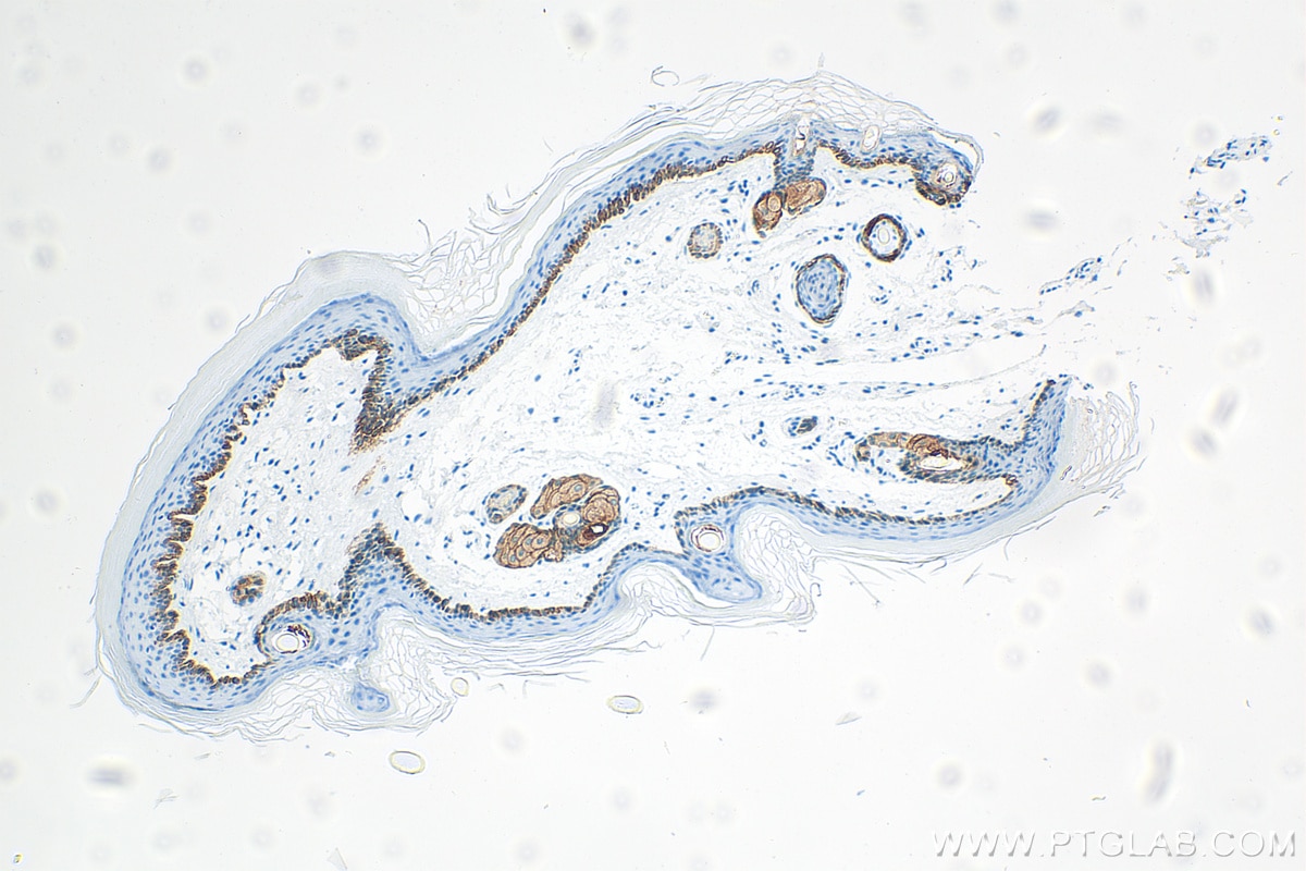 Immunohistochemistry (IHC) staining of mouse skin tissue using Cytokeratin 13 Recombinant antibody (83058-1-RR)