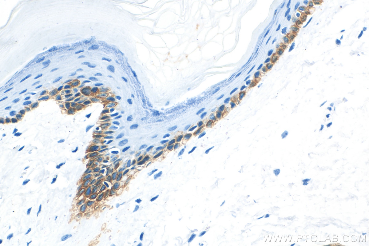 Immunohistochemistry (IHC) staining of mouse skin tissue using Cytokeratin 13 Recombinant antibody (83058-1-RR)
