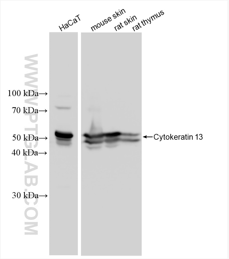 Western Blot (WB) analysis of various lysates using Cytokeratin 13 Recombinant antibody (83058-1-RR)