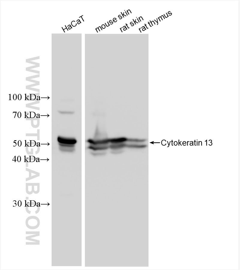 Cytokeratin 13