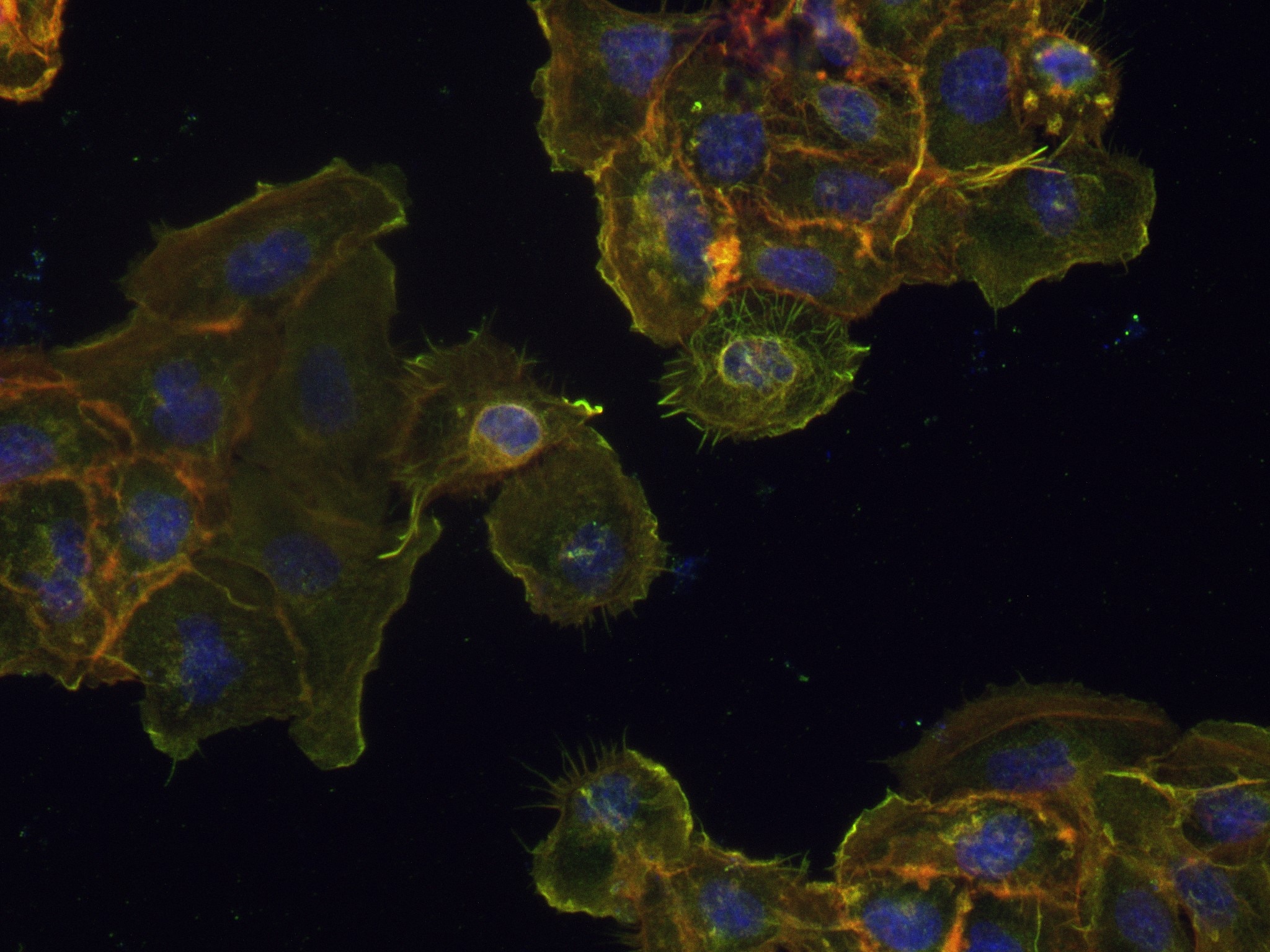 Immunofluorescence (IF) / fluorescent staining of A431 cells using Cytokeratin 13 Recombinant antibody (83058-4-RR)