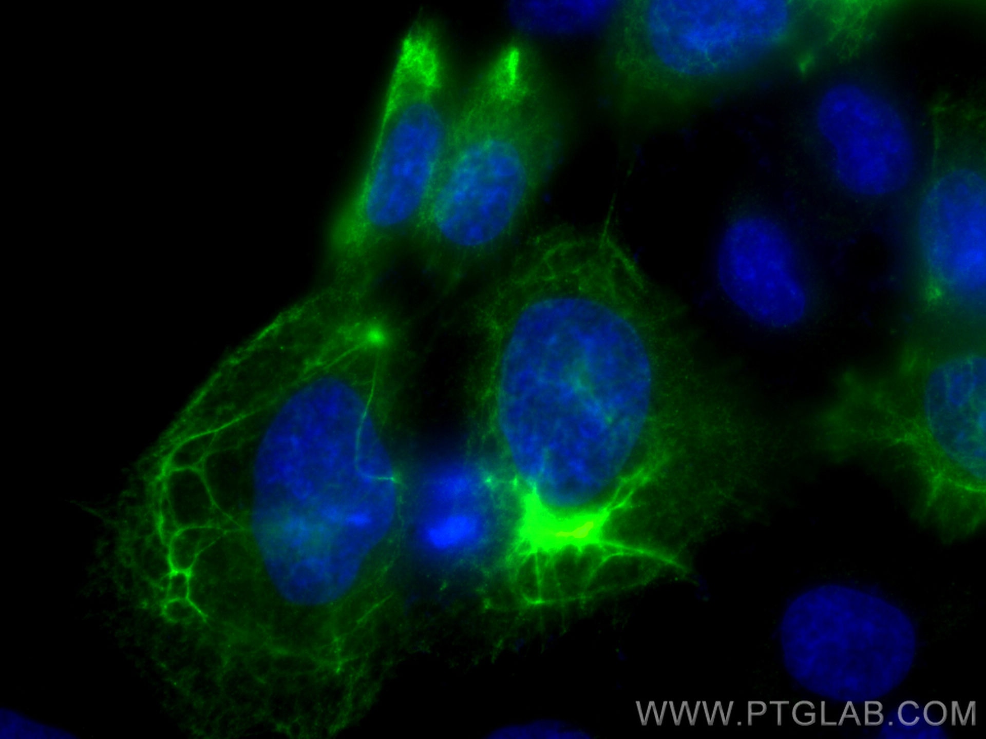Immunofluorescence (IF) / fluorescent staining of A431 cells using CoraLite® Plus 488-conjugated Cytokeratin 13 Polyc (CL488-10164)