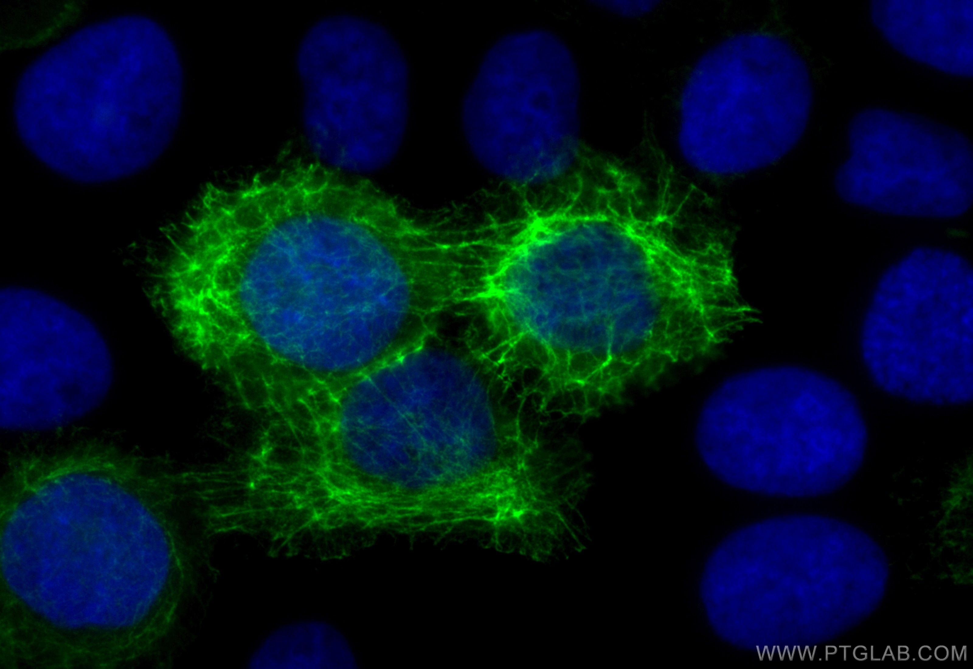 Cytokeratin 13