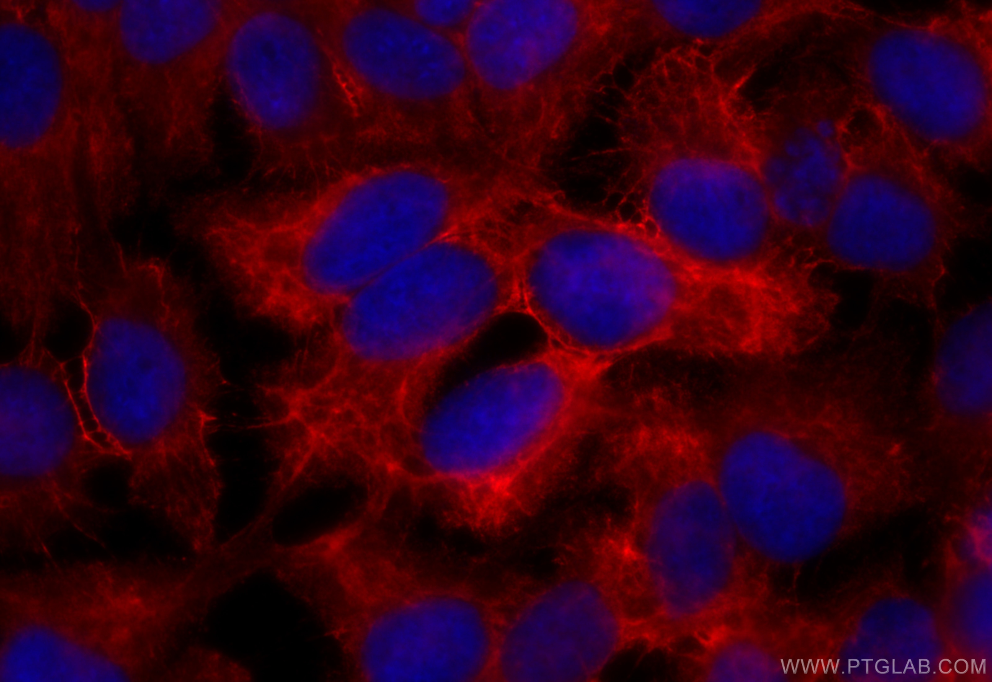 Immunofluorescence (IF) / fluorescent staining of HaCaT cells using CoraLite®594-conjugated Cytokeratin 13 Monoclonal  (CL594-66684)
