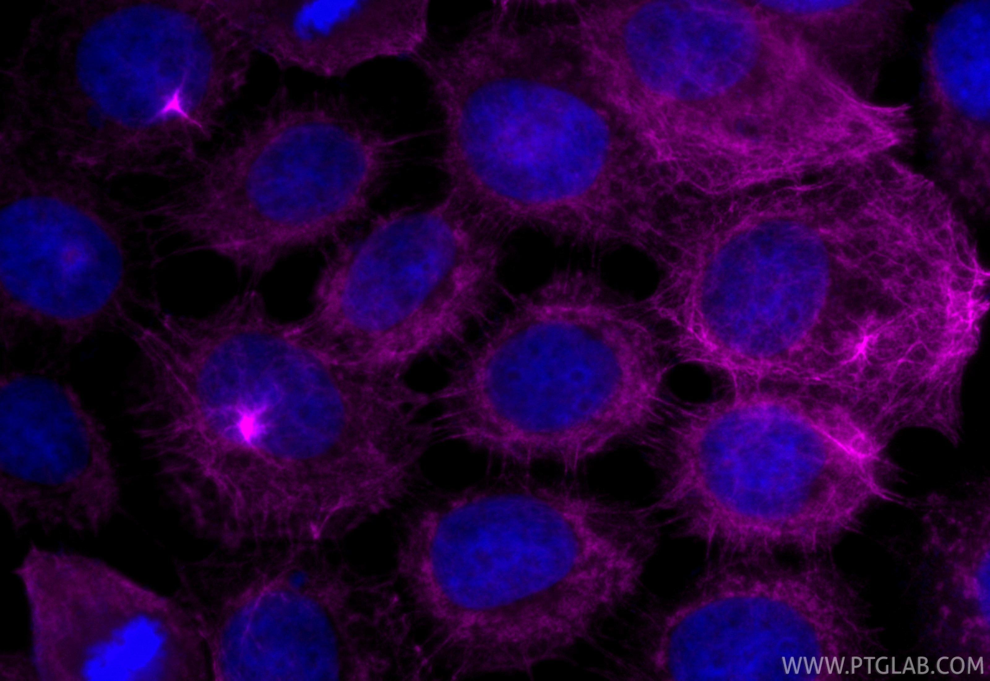 Immunofluorescence (IF) / fluorescent staining of A431 cells using CoraLite® Plus 647-conjugated Cytokeratin 13 Polyc (CL647-10164)