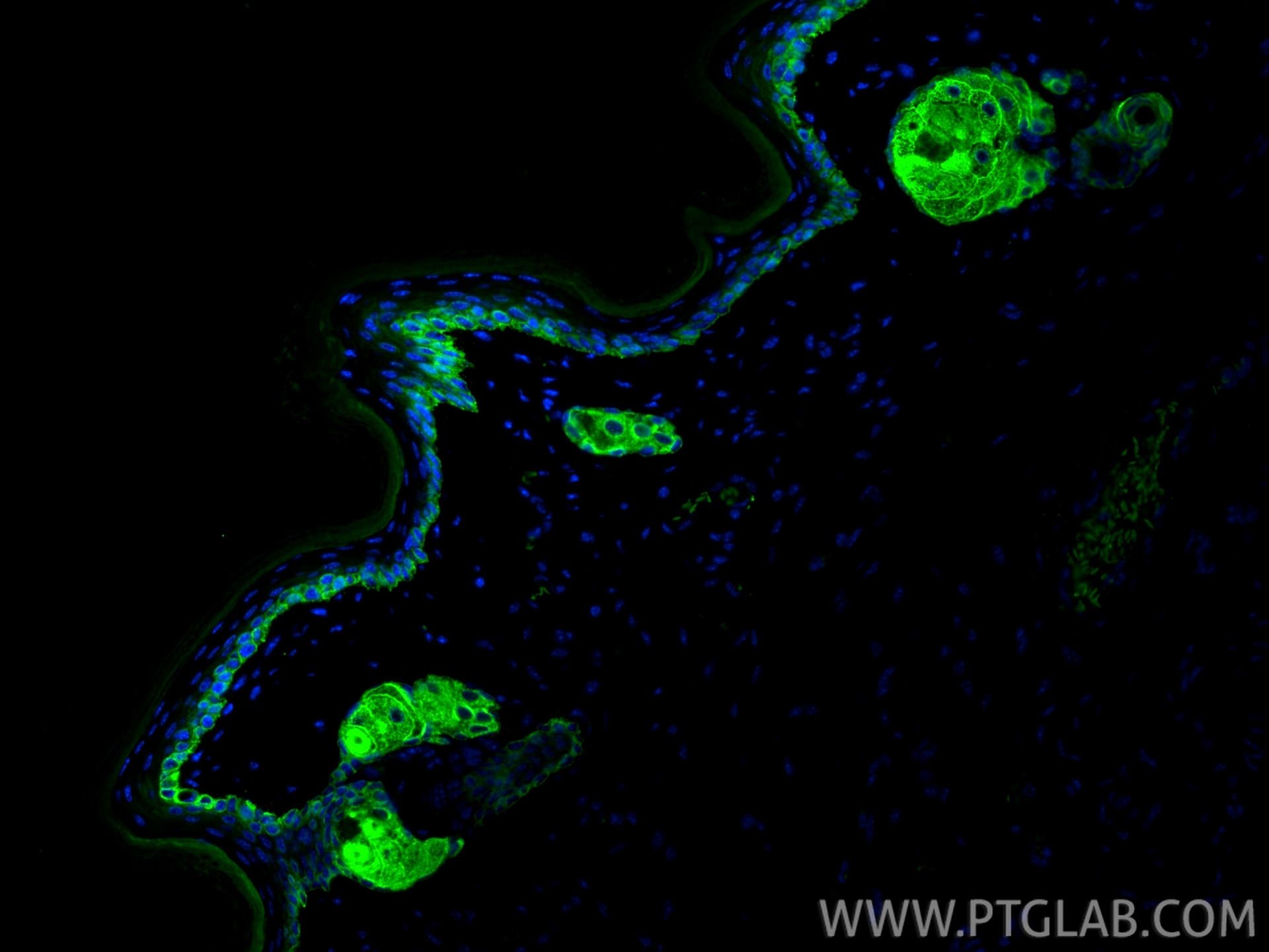 Immunofluorescence (IF) / fluorescent staining of mouse skin tissue using Cytokeratin 14 Recombinant antibody (82824-1-RR)